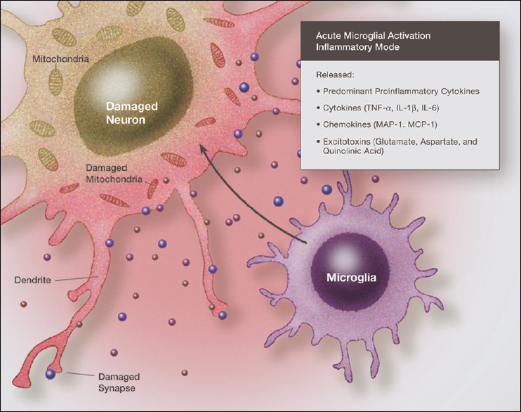 Illustration of fully activated microglia in a neurodestructive phenotype, with the release of proinflammatory cytokines, chemokines and excitatory amino acids, all acting in concert to damage the surrounding neurons
