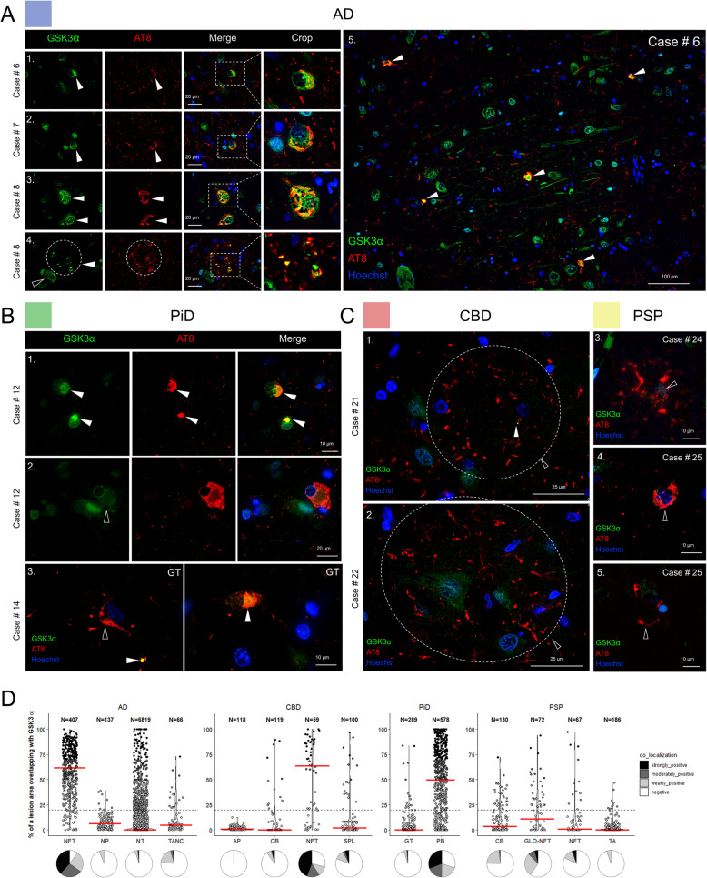 GSK3α is sequestered in distinct neuronal phospho-tau inclusions in tauopathy cortical tissue. A NFTs (series 1–3) and some phospho-tau components of NPs (series 4) co-localized with GSK3α in frontal cortex AD tissue tile image demonstrates the abundance of GSK3α and AT8 positive NFTs in AD [5]. B Some PiD phospho-tau inclusions were found to be positive for GSK3α, including neuronal PBs (series 1, white arrowheads) but not PC/BNs (series 2, unfilled arrowheads). White matter GT inclusions were either positive (white arrowheads) or negative (unfilled arrowheads) for GSK3α (series 3–4). C Astrocytic tau lesions in CBD and PSP mostly did not co-localize with GSK3α. D Quantification of GSK3α -positive phospho-tau lesions from n = 3 cases/tauopathy showing the relative area of overlap between AT8 and GSK3α in tauopathy lesions. Modified violin plots with data points show individual lesions plotted against relative overlap area. Lesions are categorized into co-localization categories based on their relative area of overlap. Red lines indicate median values. Pie charts underneath the violin plots illustrate the relative proportions of lesions with different degrees of co-localization. Abbreviations: GSK3α, glycogen synthase kinase 3 alpha; AD, Alzheimer’s disease; PiD, Pick’s disease; CBD, corticobasal degeneration; PSP, progressive supranuclear palsy; NFTs, neurofibrillary tangles; TANCs, tangle-associated neuritic clusters; APs, astrocytic plaques; CBs, coiled bodies; PBs, Pick bodies; Pick cells/BNs, Pick disease specific ballooned neurons; GT, glial tau; NTs, neuropil threads; NP, neuritic plaque; SPL, small phospho-tau lesions; TA, tufted astrocytes; GLO-NFT, globose NFTs