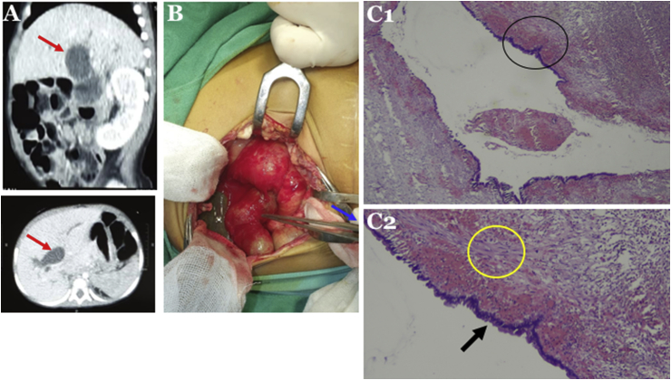 Fig. 2