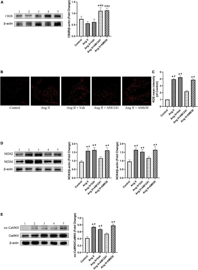 Administration of AM1241 attenuated oxidative stress in the atrial tissue of Angiotensin II-infused mice by activating cannabinoid receptor 2 (CB2R). (A) Representative western blot image and relative expression of CB2R. (B) Representative picture of reactive oxygen species (ROS) (red) by dihydroethidium staining. Bar = 100 μm. (C) Quantitative analysis of reactive oxygen species (ROS) mean intensity. (D) Representative western blot image and relative expression of NOX2 and NOX4. (E) Representative western blot image and relative expression of ox-CaMKII and CaMKII. Lane 1: control group; Lane 2: Ang II group; Lane 3: Ang II + Veh group; Lane 4: Ang II + AM1241 group; Lane 5: Ang II + AM630 group. The data represent the mean ± SEM. *P < 0.05 vs. control group. #P < 0.05 vs. Ang II + AM1241 group. @P < 0.05 vs. Ang II group. $P < 0.05 vs. Ang II + Veh group.