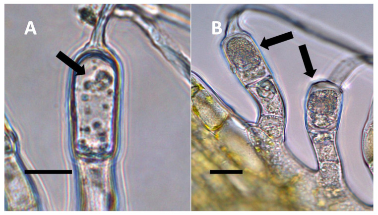 Solidago canadensis inflorescence bract non-pitted trichomes. (A) Developing trichome stained with acidified diphenylamine showing nitrate (blue color) around bacteria (arrow) in hair (Bar = 10 µm). (B) Trichome stained with acidified diphenylamine showing nitrate (blue color) around bacterial masses (arrows) (Bar = 10 µm).