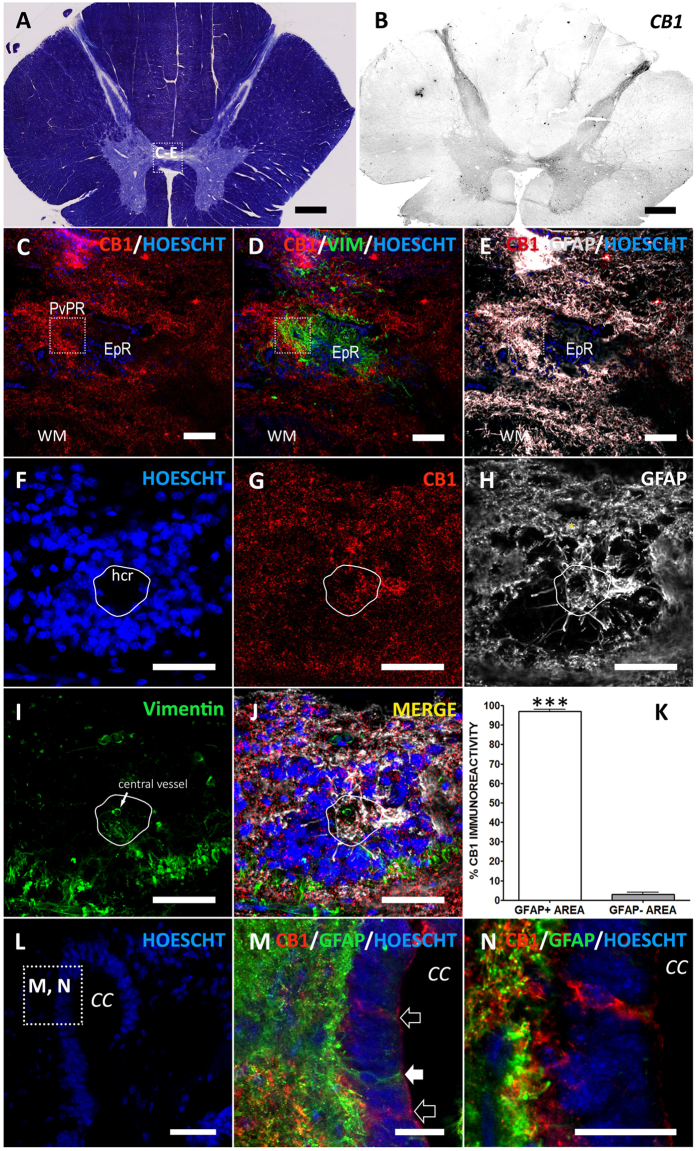 CB1 cannabinoid receptor in adult human spinal cord.(A) Myelin staining of a representative thoracic spinal cord section. Square depicts the area shown in (C–E). (B) In low magnification a strong CB1 immunoreactivity can be found in dorsal horn, lamina X and ventral gray matter. (C–E) Higher magnification of central gray shows CB1 expression in GFAP+ areas surrounding the Vimentin+ cells at the ependymary region (EpR). Square highlights the location of a perivascular pseudorosette (PvPR). (F–J) Strong CB1 immunoreactivity is found at the GFAP+ domains around and inside perivascular pseudorosettes, including the GFAP ribbon at the hypocellular region of the pseudorosette (hcr, outlined in white). In PvPRs cells are arranged around a central vessel ((I) arrow). (K) Quantification supports qualitative observations: CB1 immunoreactivity is significantly accumulated in GFAP+ areas. (L) Detail of the dorsal aspect of an ependymal region with a patent central canal. Square depicts location of images M and N. (M) CB1HIGH ependymal cells (empty arrows) can be found intermingled with ependymocytes lining the central canal. GFAP+ cells contacting central canal lumen (arrowhead) are CB1−. (N) Detail of M, showing a CB1HIGH cell with a dim staining of GFAP in the apical region. ***T student, p < 0.001; CC, Central Canal; EpR, ependymal region; hcr, hypocellular region; PvPR, perivascular pseudorosette; WM, white matter. Scale bars: A,B = 1 mm; C-E: 100 μm; F-L = 50 μm; M,N = 25 μm.