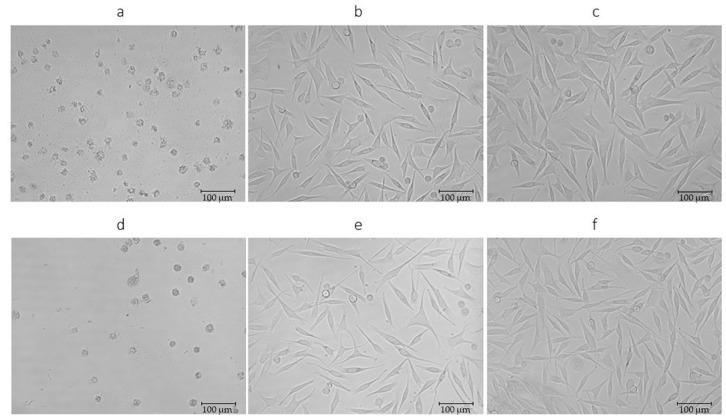 Morphology of WM-266-4 cells exposed to extract x37. (a) The response of melanoma cells upon application of 1 mg/mL concentration of SFE extract at 300 bar and 60 °C. (b) The response of melanoma cells upon application of 0.1 mg/mL concentration of SFE extract at 300 bar and 60 °C. (d) The response of melanoma cells upon application of 1 mg/mL concentration of UE extract. (e) The response of melanoma cells upon application of 1 mg/mL concentration of UE extract. (c,f) represent the control. Magnification 200×.
