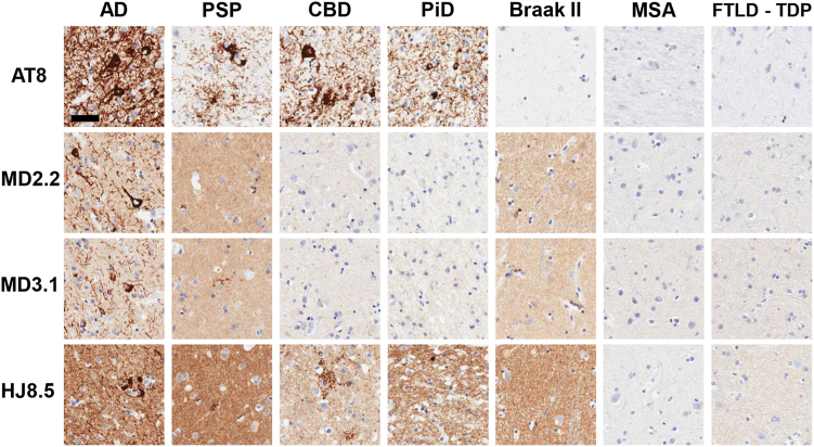 MD2.2 and MD3.1 staining of AD and PSP versus non-tauopathy brains. Immunohistochemistry of brains with AT8(+) pathology indicated more MD2.2 and MD3.1 staining in AD and PSP than in CBD and PiD. The Braak II sections are from a Lewy body dementia brain with AD NFTs only in limbic tissue and exhibited staining with MD2.2 and MD3.1. In non-tauopathy MSA or FTLD-TDP brains, there was no staining. Scale bar = 50 μm.