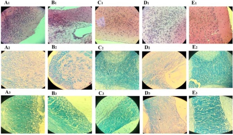 Histological findings of brain sections of mice. Group A, RAPA + HSO/EPO-treated mice show (A1) extensive infiltration of inflammatory cell, neurophagia, (A2) spongy tissue, and (A3) extensive demyelination; group B, RAPA-treated mice show (B1) focal infiltration of inflammatory cells, (B2) spongiotic zones, and (B3) demyelination; group C, HSO/EPO-treated mice show (C1) a few inflammatory cells (C2,3) without spongy lesions and demyelination; group D, control EAE mice show (D1) a great number of inflammatory cells, (D2) extensive degeneration, spongy tissue, and (D3) demyelination; group E, the section of the brain of naive mice exhibiting (E1-3) no clinical signs. The first row was stained with H&E and the second and third rows were stained with LFB. EAE, experimental autoimmune encephalomyelitis; HSO/EPO, hemp seed oil/evening primrose oil; RAPA, rapamycin; H&E, hematoxylin and eosin; LFB, luxol fast blue.