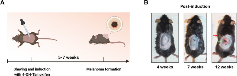 Melanoma induction in the B6-Tyr::CreERT2; BRafCA; Pten.loxP mouse model. A Schematic representation of the timeline for tumor induction and formation. B Representative images of a mouse used in this study showing tumor formation and progression after induction with 4-OHT. Green arrow indicates an induced nodular-like tumor, red arrow indicates a spontaneous tumor formed due to Cre-recombinase “leakage”