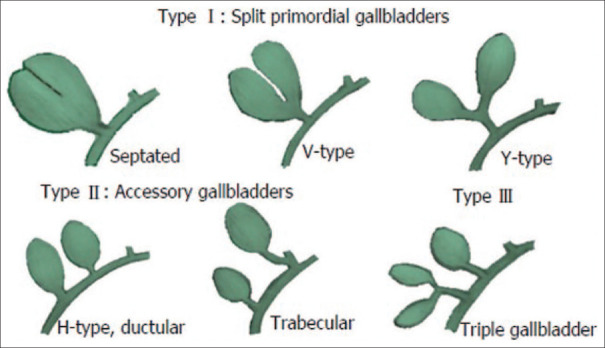 The Harlaftis's classification of anatomical variation of accessory gallbladders