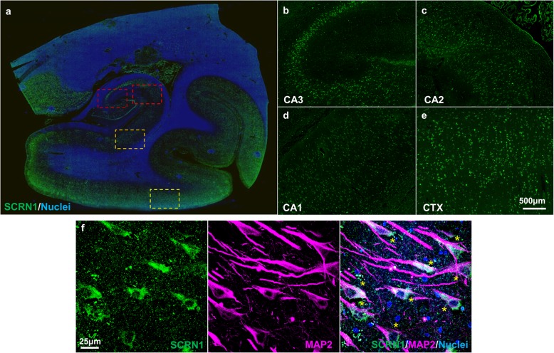 Secernin-1 distribution in the hippocampal section in a cognitively normal subject with no NFTs. a Whole-slide fluorescent scan of the hippocampus with α-SCRN1 antibody (green). Boxed regions shown in higher magnification images of CA3 (dark red, b), CA2 (red, c), CA1 (orange, d) and adjacent temporal cortex (yellow, e). f Double immunohistochemistry of SCRN1 with α-MAP2 antibody showing SCRN1 physiological expression in neurons (asterix) in a cognitively normal subject