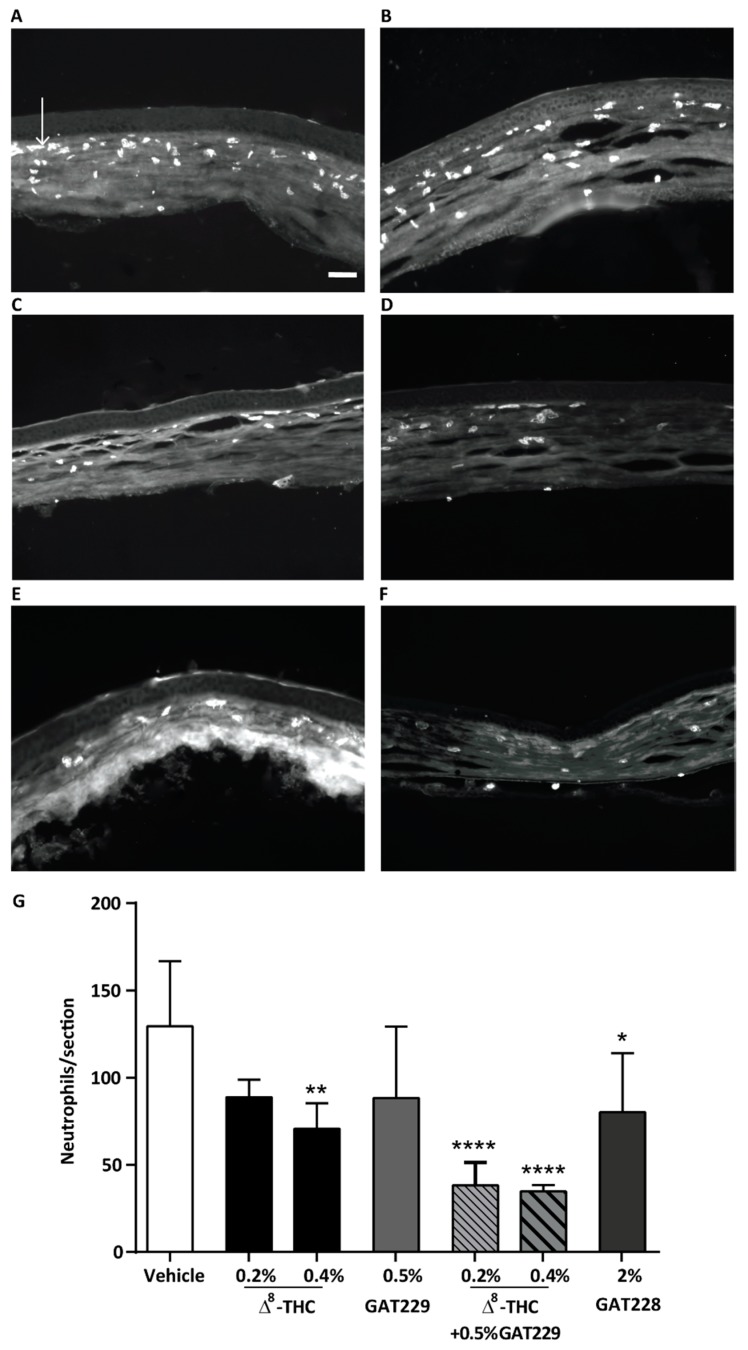 Neutrophil expression in cauterized corneas at 6 h post injury following the topical treatments of drug or vehicle and capsaicin stimulation. Representative images of transverse sections of the central cornea from (A) vehicle-treated corneas, (B) 0.2% Δ8-THC-treated corneas, (C) 0.5% GAT229-treated corneas, (D) 2% GAT228-treated corneas and (E) 0.2% Δ8-THC + 0.5% GAT229, (F) 0.4% Δ8-THC + 0.5% GAT229 and (G) effects of topical treatment of WT cauterized eyes with (0.2 and 0.4%) Δ8-THC, 0.5% GAT229, 2% GAT228 or, 0.2% or 0.4% Δ8-THC + 0.5% GAT229 (n = 4–6 per group) in neutrophil infiltration compared to vehicle-treated eyes (n = 7). Values represent mean ± SD. Arrow in (A) points to one of many infiltrating neutrophils. Scale bar: 50µm. For statistical analysis one-way ANOVA with Dunnett’s post hoc test (compared to vehicle) was used. * p < 0.05, ** p < 0.01, **** p < 0.0001.