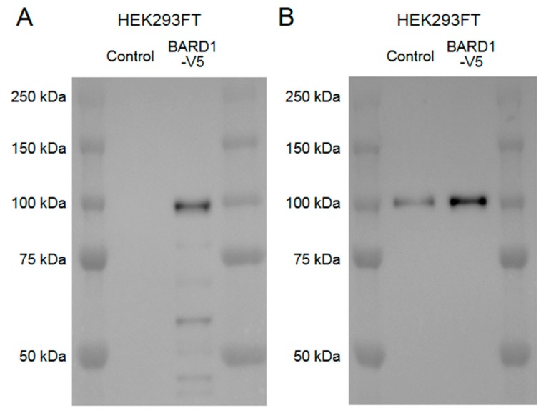 Western blot results to validate immunoreactivity and specificity of the anti-BARD1 antibody used in this study. Cell lysates of HEK293FT cells with or without transfection of pcDNA6.2-BARD1-V5 plasmid were used. (A) A western blot using anti-V5 antibodies showed a 100 kDa band and some smaller molecular weight weaker signal bands only in the cell sample transfected with the BARD1-V5 plasmid. (B) A western blot using anti-BARD1 antibody showed a single band at 100 kDa as well in cells both with and without transfection, which shows a stronger signal in the cell sample transfected with BARD1-V5 plasmid.