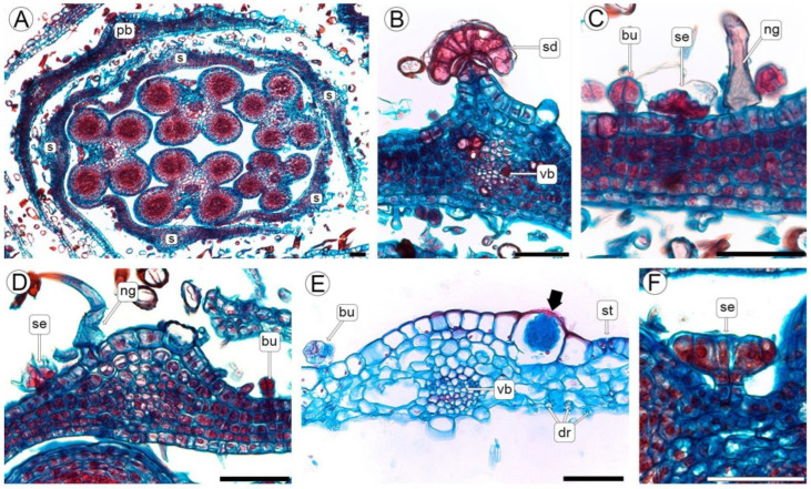 Anatomy of the male flower (LM). (A) Cross-sections of male flower showing the perigonal bract, sepals, and anthers. (B,C) Perigonal bract. (D) Sepal from a flower bud with trichomes. (E) Sepal from a flower at anthesis, showing druses and the base of a non-glandular cystolithic trichome (arrow). (F) Detail of a sessile capitate trichome of the anther. Abbreviations: bu, bulbous trichome; dr, druse; ng, non-glandular trichome; pb, perigonal bract; s, sepal; se, sessile capitate trichome; sd, stalked capitates trichome; sg, stigmatic branches; st, stomata; vb, vascular bundle. Scale bars: (A–F) = 50 µm.