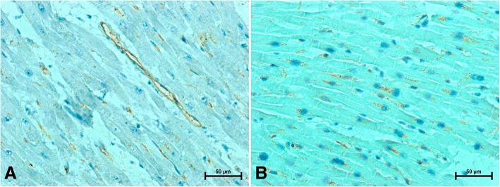 Representative images of apelin immunolabeling in the heart of women (a) under 50 (b) over 50 years old