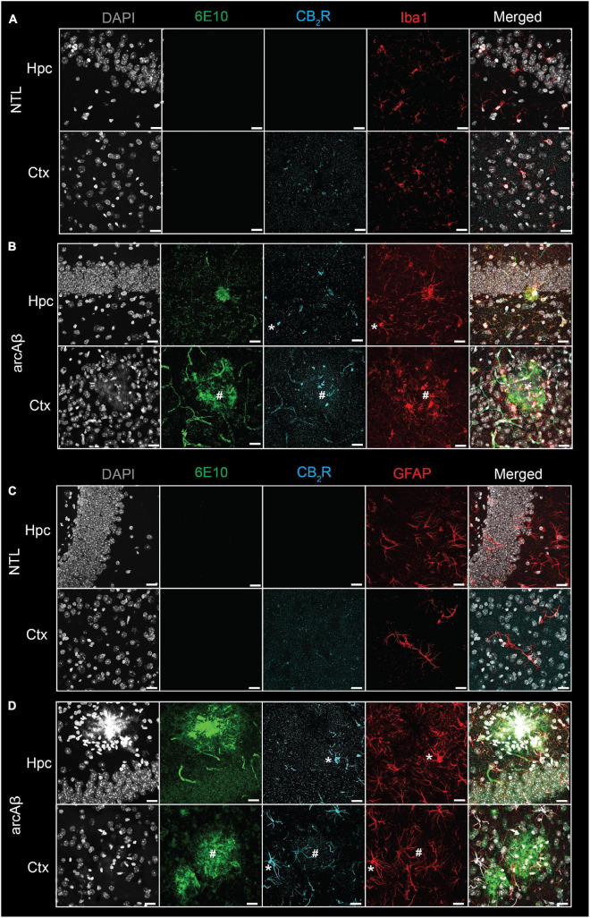 Increased cannabinoid type 2 receptor (CB2R) in microglia and astrocytes associated with amyloid-beta deposits in 17-month-old arcAβ mice. (A,B) Brain tissue sections of non-transgenic littermate (NTL, n = 3) and arcAβ mice (n = 3) were stained for Aβ (6E10 antibody, green), CB2R (cyan), and Iba1 (red) in the hippocampus (Hpc) and cortex (Ctx). Increased CB2R and Iba1 immunoreactivity inside and surrounding the plaque. (C,D) Staining for Aβ (6E10, green), CB2R (cyan), and GFAP (red) in the Hpc and Ctx. Nuclei were counterstained with DAPI (white). Increased CB2R and GFAP immunoreactivity inside and surrounding Aβ plaques. *Localization of CB2R on microglia or astrocytes outside plaque, #Colocalization of CB2R on microglia or astrocytes within plaque. Scale bar = 20 μm. CB2R immunoreactivity was detected on both microglia and astrocytes.