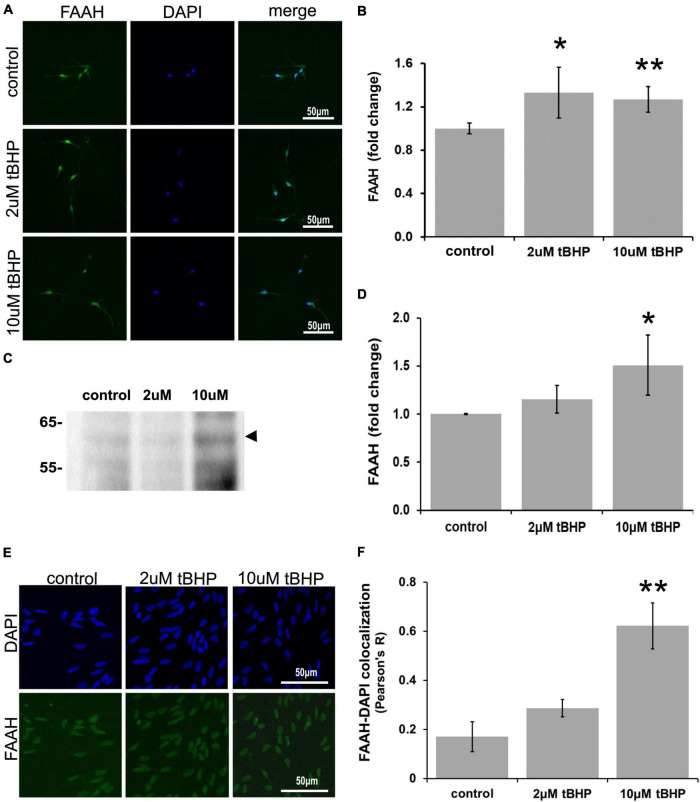 Expression of fatty acid amide hydrolase (FAAH) in ReN cells under conditions of oxidative stress. Exposure of ReN cells to sublethal concentrations of tert-butylhydroperoxide (tBHP) led to an increase in FAAH expression (A,B). Green fluorescence is FAAH and blue fluorescence is DAPI. (C,D) Western blot analysis reveals that the expression of a 63 kDa band corresponding to FAAH is unaffected by exposure to 2 μM tBHP but upregulated 1.5-fold by 10 μM tBHP. The expected molecular weight of FAAH is 63 kDa. (E,F) Colocalization analysis between FAAH immunoreactivity with DAPI fluorescence (DNA) reveals low colocalization at resting untreated conditions (R = 0.18), but 2 μM tBHP exposure led to a 68% increase in Pearson’s R (from 0.17 to 0.28). Higher tBHP concentrations (10 μM) led to a large (3.6-fold) increase in FAAH-DAPI colocalization (from R of 0.17 to 0.62), suggesting significant FAAH localization in the nucleus near DNA. *p ≤ 0.05, **p ≤ 0.01.