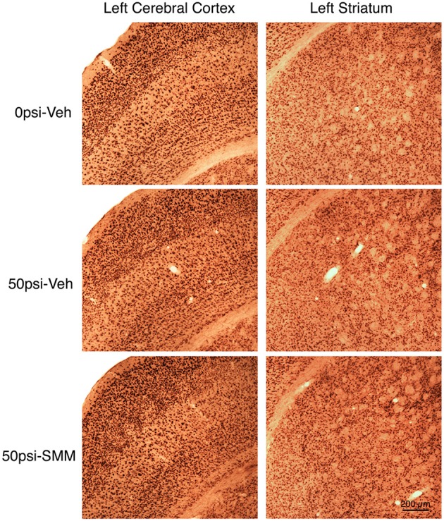 Images showing the effect of TBI and SMM-189 on NeuN+ neurons in left cerebral cortex and striatum at 2–3 months post-blast. Neither focal nor diffuse neuron loss is evident in the 50-psi vehicle-treated cortex or striatum, compared to 0-psi vehicle-treated cortex and striatum. Similarly, the abundance of cortical and striatal neurons does not appear obviously different in the 50-psi SMM-189 treated mice from that in either of the other two groups. Magnification is the same for all panels. Stereology, nonetheless, revealed neuron loss in both in 50-psi vehicle-treated mice.