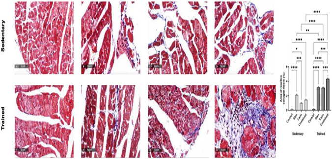 Masson’s Trichrome stain of deposited collagen fibers in interstitial connective tissue. Significant accumulation of collagen fibers (blue stain) was observed after stanozolol (B, F), cannabis (C, G), or both substances (D, H) administration to sedentary (upper row) and trained (lower row) rats. Training resulted in more significant deposition in treated rats. Six non-overlapping sections were examined and collagen deposited area percentage was determined using Full HD microscopic imaging system (Leica Microsystems GmbH, Germany) operated by Leica Application software for tissue sections analysis at magnification of ×100 and ×400. Data in graph are presented as mean ± SEM and tested for significance at p < 0.05 using two-way ANOVA followed by Tukey's multicomparison test (n = 6)