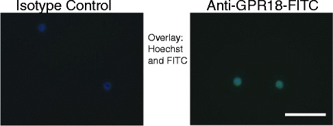 Fluorescence micrographs of GPR18 immunoreactivity. Neutrophils on glass coverslips were fixed with 2 % paraformaldehyde in HBSS and stained with anti-GPR18 antibody (right panel) or isotype control (left panel), then washed and incubated with the secondary FITC-conjugated detection antibody (green). Cells were mounted with Hoechst 33258 (Sigma-Aldrich, Oakville, Ontario, Canada) (blue). No immunoreactivity was detected in the control cells, but most neutrophils expressed GPR18. Scale bar = 100 μm