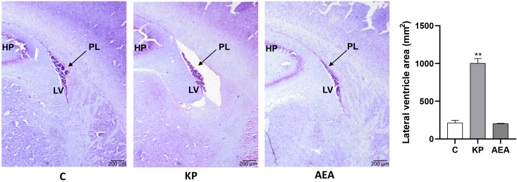 Morphological evaluation of the lateral ventricle. Representative images (n = 4 for each animal group) of Nissl staining showing the lateral ventricle of the control and treated animals. C, control; KP, animals injected with Kp10; AEA, animals injected with AEA; SR + AEA, animals first received SR141716A and 30 min later received AEA treatment. HP, hippocampus; LV, lateral ventricle; PL, choroid plexus. Magnification ×4. **p< 0.01.
