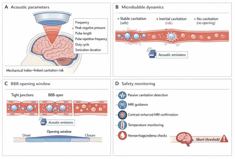 Focused ultrasound (FUS) delivery paradigm: acoustic control, microbubble cavitation, transient blood–brain barrier (BBB) opening, and safety monitoring. The schematic summarizes the focused ultrasound (FUS)–microbubble paradigm for transient, spatially targeted BBB modulation to enable CNS delivery. (A) Acoustic parameters (frequency, peak negative pressure, pulse length, pulse repetition frequency, duty cycle, and sonication duration) set the cavitation regime and therefore the balance between efficacy and risk. (B) Microbubble dynamics span a spectrum from no response (insufficient opening) to stable cavitation (desired oscillation that increases permeability) and inertial cavitation (collapse associated with vascular damage risk). These regimes are inferred in real time using acoustic emissions and passive cavitation detection to support parameter adjustment and stop rules. (C) BBB opening window is depicted as a reversible permeability increase (minutes–hours) during which small molecules, prodrugs, and nanocarriers can cross the endothelium; closure restores barrier integrity. (D) Safety monitoring includes image-guided targeting (MRI), confirmation of opening (contrast-enhanced MRI), surveillance for edema or microhemorrhage, and temperature/physiological checks where relevant. Together, the framework links controllable acoustic inputs to microbubble behavior, delivery timing, and verification steps required for reproducible, trial-grade BBB opening. BBB, blood–brain barrier; CNS, central nervous system; FUS, focused ultrasound; MRI, magnetic resonance imaging.