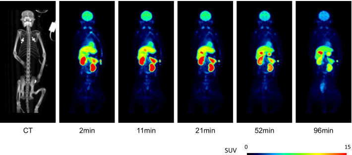 Representative whole-body PET images of [11C]PF-06809247