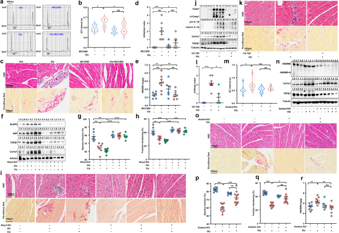 Genetic knockout or pharmacologic inhibition of cell pyroptosis significantly alleviated antipsychotic-induced myocardial injuries. a–e Effects of MCC950 (20 mg/kg), a specific NLRP3 inhibitor, on Olz cardiotoxicity (n = 5–7 mice/group). f–i Effects of genetic knockout of Nlrp3 (Nlrp3-KO) on AP drugs-induced activation of pyroptosis and cardiotoxicity were assessed (n = 5–8 mice/group). The values above each protein blot (f) represent the ratio of protein intensity to actinin. j, k Effects of VX-765 (50 mg/kg), a specific Casp1 inhibitor, on Olz cardiotoxicity (n = 5 mice/group). The values above each protein blot (j) represent the ratio of protein intensity to tubulin. l–r Effects of genetic knockout of Gsdmd (Gsdmd-KO) on Olz cardiotoxicity (n = 6–9 mice/group). Scale bar = 100μm. The values above each protein blot (n) represent the ratio of protein intensity to tubulin. All quantification represents the mean and SEM of each group. Two-way ANOVA was used for all analyses. ns, no significance. *p < 0.05; **p < 0.01; ***p < 0.001 as indicated