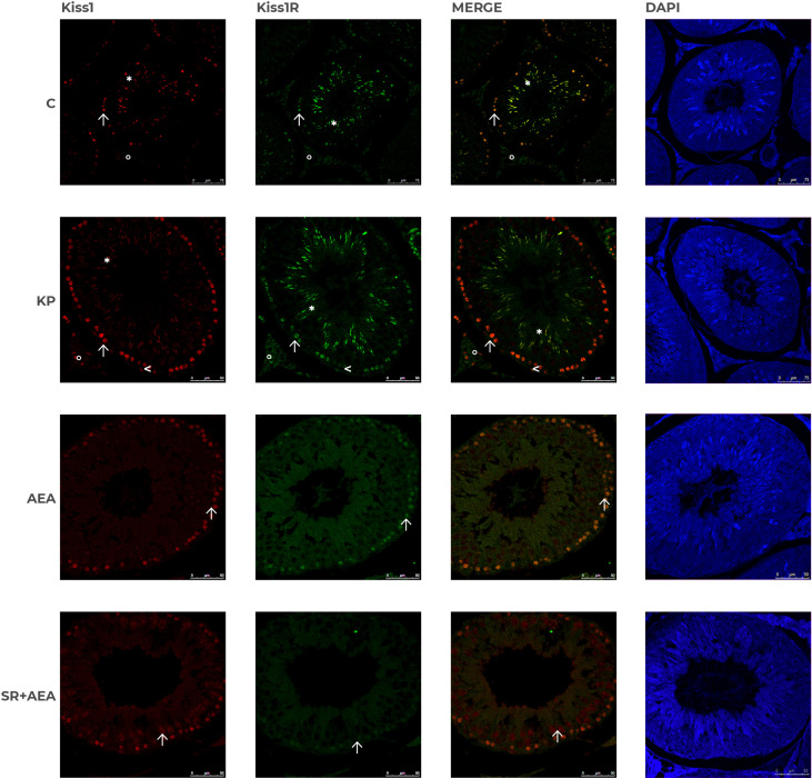 Distribution of Kiss1 and Kiss1R in rat testis treated with KP and AEA. Double immunofluorescence of Kiss1 (red) and Kiss1R (green) expression in control (C), kisspeptin (KP), anandamide (AEA), and SR141716A (SR + AEA)-treated animals (n = 4 for each group). The last column shows the representative images of DAPI staining on the same animals. Magnification = C ×40; KP, AEA, and SR+ AEA, ×63. * Elongated spermatids, ↑ spermatocytes, ^ spermatogonia, ° interstitium.