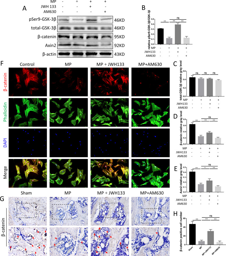 Activity changes of GSK-3β/ β-catenin signaling pathway in vitro and in vivo.A–E Expression levels of pSer9-GSK-3β, total GSK-3β, Axin2, and β-catenin, n = 3 per group. F Immunofluorescence staining, red (β-catenin), green (phalloidine), blue (nuclei). G, H Immunohistochemical staining and analysis for β-catenin, n = 10 per group (data are shown as mean ± SD, *p < 0.05; **p < 0.01; ns, not significant).