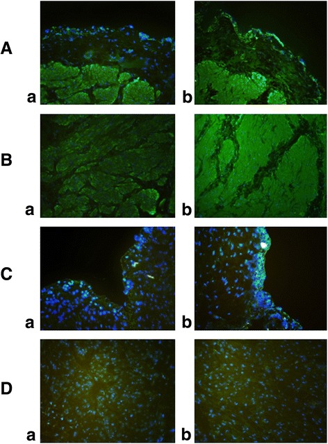 Immunofluorescence staining of CB1 and CB2 receptors. a and b show that there were significant increases in CB1 receptor immunoreactivity in the urothelium (a) and detrusor muscle (b) of rats in the BOO group. c and d show that there were no differences in CB2 receptor immunoreactivity in the urothelium (a) and detrusor muscle (b) between the control group and the BOO group. Green shows CB1 or CB2 receptor expressing cells and blue dots show DAPI staining of nuclei. BOO:bladder outlet obstruction. CB:cannabinoid