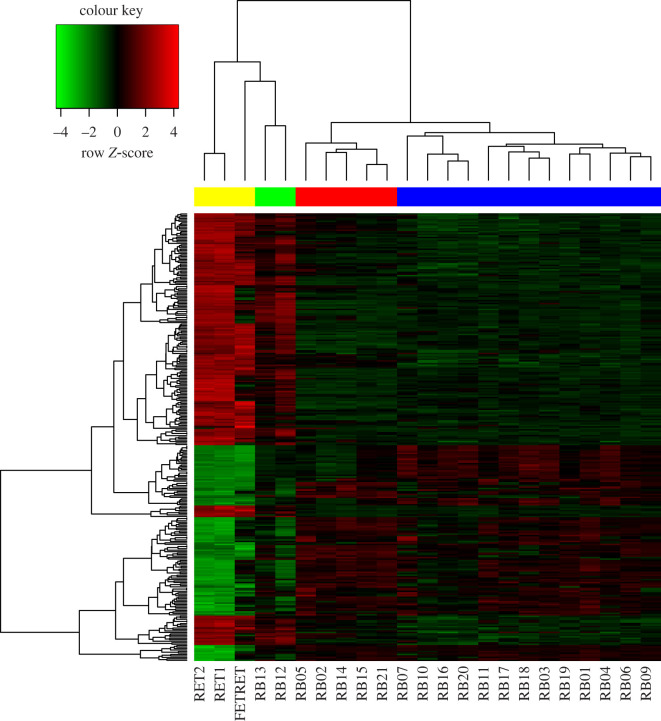 Heatmap of microarray expression z-scores computed for all genes that are differentially expressed (absolute LFC > 2 and adjusted p-value <0.05) between Rb (20 samples) and normal retina (3 samples). This heatmap shows the normalized expression values for 305 DEGs. Each row represents a gene and each column a sample (23 individual samples). Most Rb samples clustered in two branches indicated with the red and blue bars. Over-expressed genes are represented in red, and under-expressed genes are represented in green. Sample colour code: normal retina samples, yellow; Rb samples: green = normal-like, red = subgroup 2 and blue = subgroup 1. Normalization (z-score by row) was applied to improve visualization.