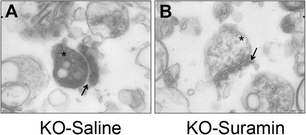 Cerebral synaptosome structural abnormalities were improved by antipurinergic therapy. (A) Fragile X knockout model treated with saline (KO-Saline). Note the increased electron density (dark staining) of the synaptosomal matrix (*) and the hypomorphic (thin) margins of the post-synaptic density (indicated by the arrow). Age 25 weeks, N = 3 per group. Scale bar = 200 nm. (B) Fragile X knockout model treated with suramin (KO-Suramin). Note the normal appearing, electron lucent synaptosomal matrix (*) and the thicker margins of the post-synaptic density (indicated by the arrow). Age 25 weeks, N = 3 per group. Scale bar = 200 nm.