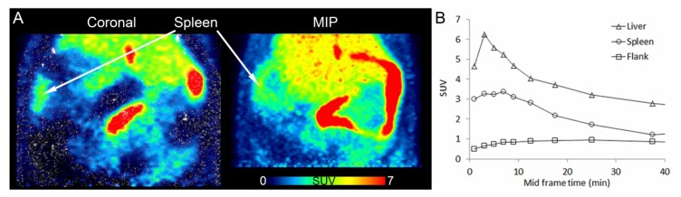 PET/CT images of [11C]KP23 in the spleen-liver region in rat. (A) Coronal section and maximal intensity projection (MIP) averaged from 6 to 15 min p.i. (B) TACs of [11C]KP23 in spleen, liver and flank.