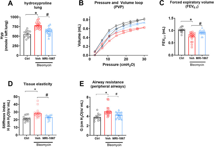 Dual target inhibition of CB1R and iNOS prevented decline with PF in HpsPF mice. (A) Hydroxyproline content as fibrosis measurement. (B) Pressure‐volume curve, (C) forced expiratory volume, (D) tissue elasticity, and (E) tissue damping as measures of lung function. Data represent mean ± SEM. n = 13 mice for control (Ctrl, pale ear mice infused with saline instead of bleomycin), n = 18 HpsPF mice for vehicle (Veh), and n = 18 HpsPF mice for MRI‐1867 (MRI‐1867)‐treated groups. Data were analyzed by one‐way ANOVA followed by Dunnett's multiple comparisons test. * (p < 0.05) indicates significant difference from the control group. # (p < 0.05) indicates significant difference from the HpsPF mice treated with vehicle (Veh) at 42 day