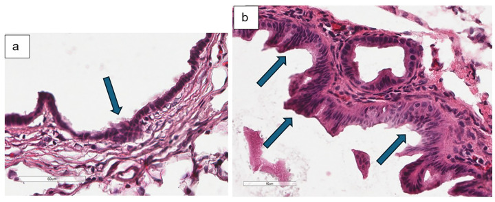 a Hematoxylin and eosin staining of experimental mouse bile duct harvested at 12-weeks old demonstrates minimal epithelial changes as illustrated by focal hyperplasia indicated by blue arrow (40x magnification) b another experimental mouse exhibits mild epithelial changes as illustrated by diffuse hyperplasia indicated by blue arrows (40x magnification)