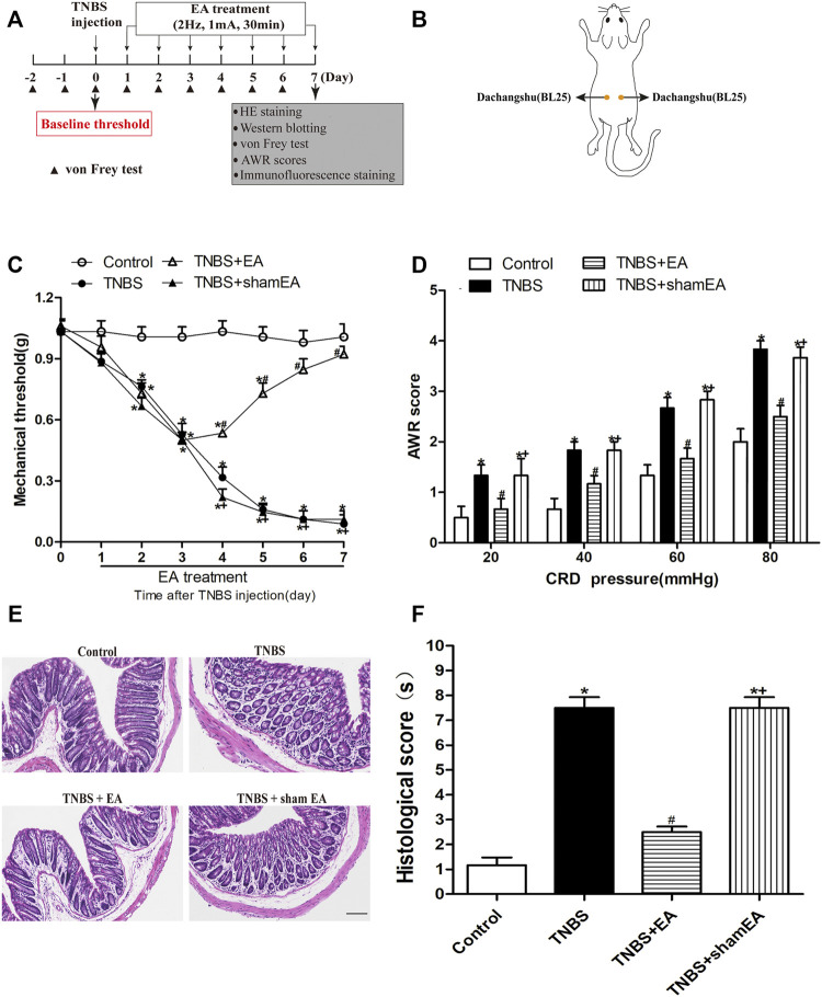 EA attenuates TNBS-induced mechanical allodynia, visceral hyperalgesia and inflammatory in the intestine. (A) Experimental flowchart. (B) Schematic show the lumbodorsal BL25 acupoint. (C) Time course of the effect of BL25 EA on mechanical withdrawal threshold of the hind paws of TNBS-treated mice. (D) AWR scores of vehicle-treated and TNBS-treated mice on day 7 after vehicle or TNBS treatment. (E) Representative H&E staining of the colon tissue sections. Scale bar, 200 µm. (F) Histological score in each group (n = 6 per group). *p < 0.05 versus with Control group, #p < 0.05 versus with TNBS group, +p < 0.05 versus with TNBS + EA group.