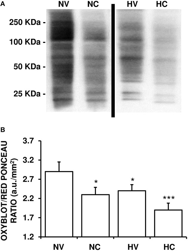 Effect of the treatments on the characteristics of oxidative stress. (A) A representative image of immunoblotting indicating protein carbonyl formation (Oxyblot) using anti-DNPH antibody. Samples were obtained using brain tissue from 1- to 2-day-old piglets after hypoxic-ischemic insult, treated with normothermia or hypothermia and administered with either vehicle or cannabidiol. (B) Relative protein carbonyl levels were quantified by densitometric analyses of the blots. The content of oxidized proteins was normalized by total Red Ponceau-stained protein loading and expressed as OxyBlot/Red Ponceau ratio (see Materials and Methods for details). Bars represent mean ± SEM of 6–8 experiments. (a.u.) arbitrary units; (*) P < 0.05 vs. NV group by Kruskall-Wallis one-factorial analysis of variance; (***) P < 0.05 vs. all groups by Kruskall-Wallis one-factorial analysis of variance.