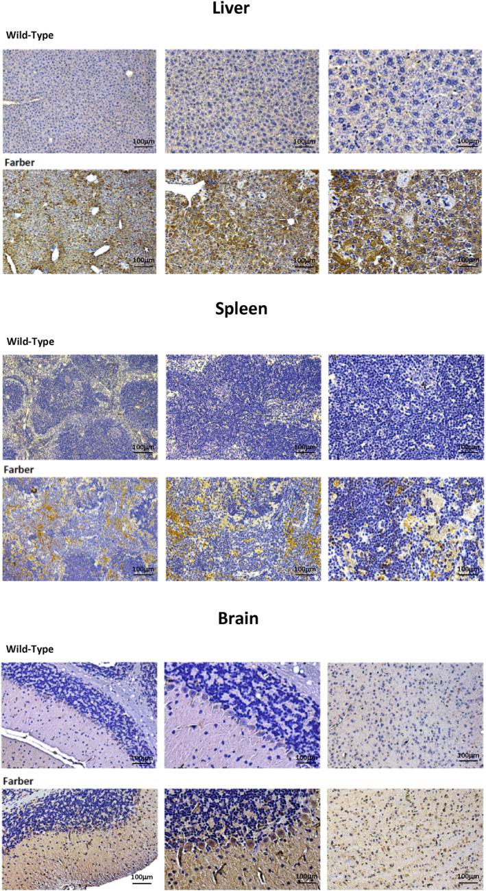 CB2R expression in Farber disease mouse tissues. CB2R was detected in tissues of 2‐month‐old Farber and wild‐type (WT) mice by immunohistochemical (IHC). Six mice/group were analyzed and representative images are shown (a minimum of 5 sections were analyzed/mouse). Brown staining indicates CB2R.