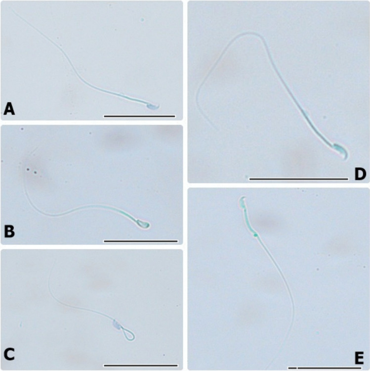 Normal and abnormal sperm images. A Normal sperm. B Head-abnormal sperm. C Neck-abnormal sperm. D Tail-abnormal sperm. E Cytoplasmic droplet sperm (scale bars 20 µm)