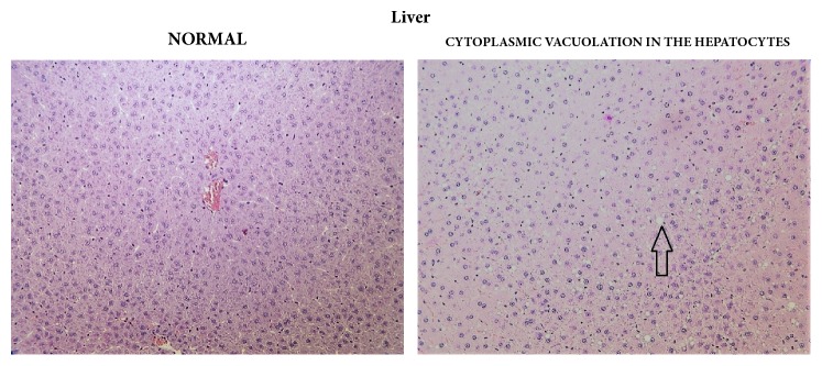 Liver: comparison of normal (control) tissue to hepatocytes of a male from the 3000/4000 mg/kg bw/day group showing cytoplasmic vacuolation, 14-day study.