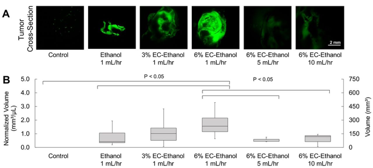 Relationship between EC concentration, flow rate and intra-tumoral ethanol retention.(A) Widefield fluorescence microscopy of large (1 cm3) 67NR flank tumors cross-sections after 150 μL injections of pure ethanol, 3% EC-ethanol, or 6% EC-ethanol at flow rate of 1 mL/hr and for 6% EC-ethanol at additional flow rates of 5 mL/hr and 10 mL/hr. (B) Intra-tumoral retention volume normalized by injection volume of 150 µL.