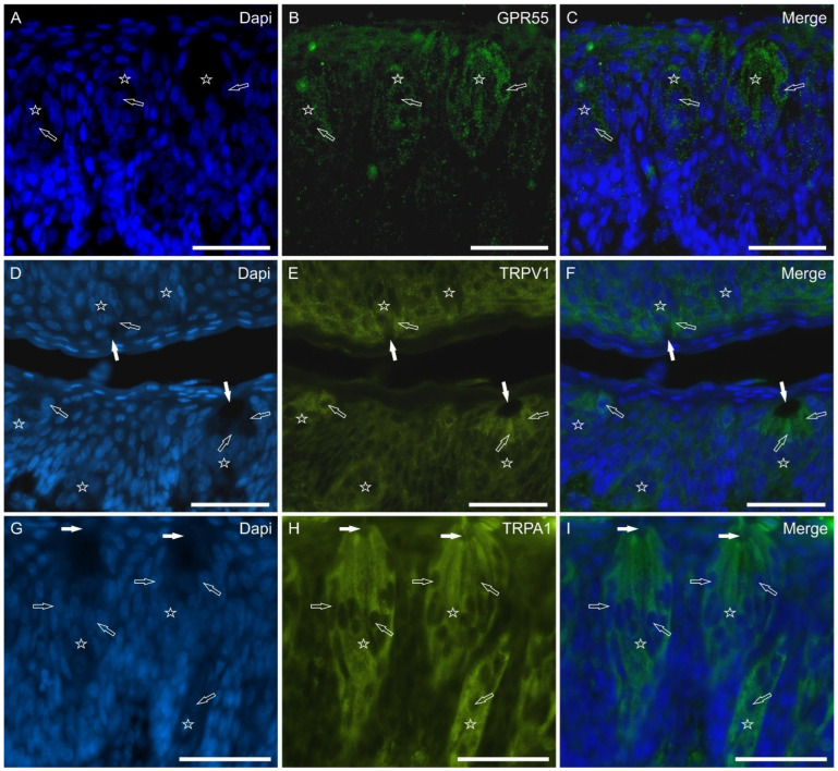 Photomicrographs showing cryosections of the piglet papillae vallatae (A–C,G–I) and foliatae (D–F) in which anti-GPR55, TRPV1, and TRPA1 antibodies were applied. The stars indicate the taste buds. The white arrows indicate the taste pores of some taste buds; the empty arrows indicate the nuclei of taste cells positive for GPR55 (A–C), TRPV1 (D–F), and TRPA1 (G–I). (C,F,I): merged images. Scale bar: 50 µm.