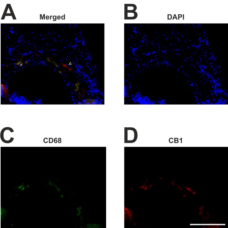 Immunofluorescent costaining of CB1 and CD68.Frozen sections through the aortic sinus were stained for CD68 and CB1 using Cy2 (green, C) and Cy3 (red, D) fluorochroms. Nuclei are stained with DAPI (blue, B). Lesional CD68-positive monocytes and macrophages (C) are the main contributors to lesional CB1 receptor expression (D) Very few cells express CB1 which do not express CD68 (arrow head, A). Scale bar, 200 μm. CB1, cannabinoid receptor 1; CD68, cluster of differentiation 68; DAPI, 2-(4-amidinophenyl)-6-indolecarbamidine dihydrochloride.