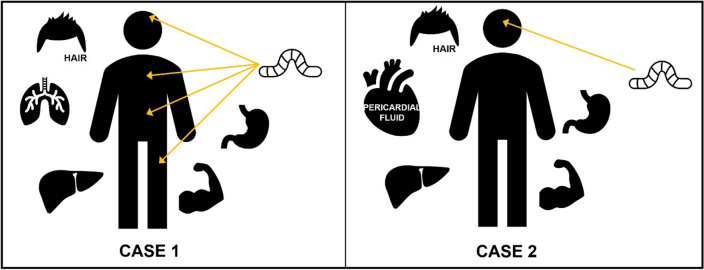 Graphical representation of the different matrices used for toxicological analysis of cases 1 and 2, respectively, including the areas from which larvae were collected for each case