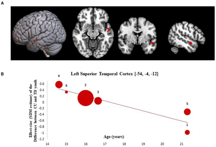 Meta-regression results showing associations between age at scan with gray matter differences between cannabis using and typically developing youth. Age-related meta-regression results. (A) Meta-regression results (CU > TD youth) showing associations between Age at Scan and gray matter differences between CU and TD youth shown in red. All results thresholded at p < 0.005. (B) Associations between age and gray matter differences in the left superior temporal cortex (85 voxels, SDM-Z = −3.168) (shown in red). Effect sizes (SDM-estimates) used to create the meta-regression plots were extracted from the peak of maximum slope significance. The meta-regression SDM-estimate value is derived from the proportion of studies that reported gray matter changes near the voxel so it is expected that some values are at 0 or near +/– 1. Each included study is represented as a numbered dot, with the dot size reflecting relative total sample size of each specific study in comparison to the average total sample size of all six studies included in the regression. Study key: 1 = Gilman et al. (39); 2 = Thayer et al. (41); 3 = Weiland et al. (11); 4 = Orr et al. (12); 5 = Cousijn et al. (40); 6 = Jarvis et al. (42).