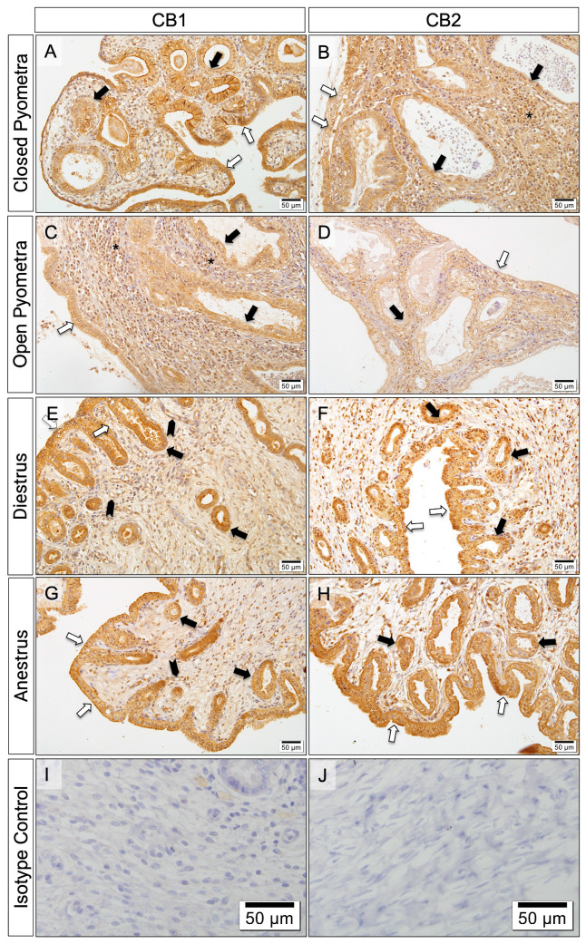 Immunolocalization of CBs in uterine tissue (bar: 50 μm-×20). Immunoreactivity of CB1 in different areas of the uterus by groups; CP (A), OP (C), DE (E), AE (G). Immunoreactivity of CB2 in different areas of the uterus by groups; CP (B), OP (D), DE (F), AE (H). No immunoreactivity in isotype controls (I,J). White arrows: luminal epithelial cells; black arrows: endometrial gland cells; *: immune cells.