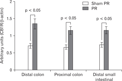 Expression of cannabinoid type 1 receptor (CB1R) in distal colon, proximal colon and distal small intestinal following repeated partial restraint stress (PR). Levels of CB1R protein measured by Western blotting. A significant increase in the level of CB1R protein in samples from chronic PR stress rats compared with control was observed. Data are expressed as normalized optical density, mean ± SEM, n = 8 in each group.