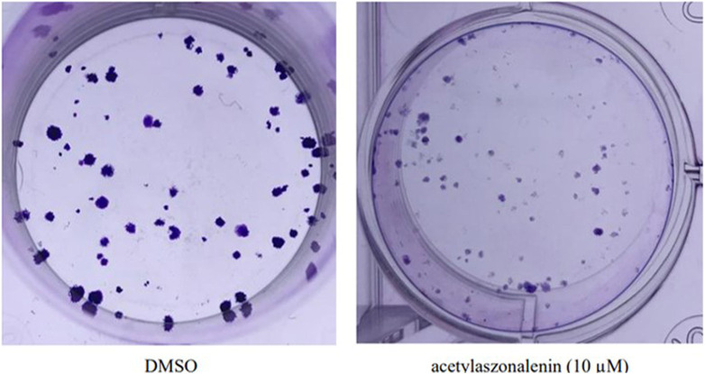 Effect of acetylaszonalenin (2) on the clonognic survival of 22Rv1 human prostate cancer cells. Photographs show numerous cell colonies in DMSO-treated cells (negative control), while minimal colonies are seen at 10 µM of acetylaszonalenin indicating a significant suppression of clonogenic growth.