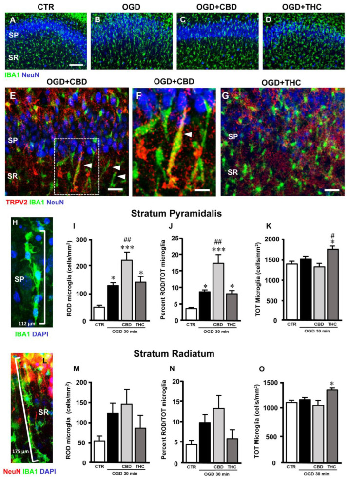 (A–D) Representative confocal images of immunostaining of neurons (NeuN, blue) and total microglia (IBA1, green) in CA1 SP and SR of CTR (A), OGD (B), OGD + CBD (C), and OGD + THC (D) slices. Images are z-projections of a single confocal z-scan captured with a 20× objective (total thickness: 1.2 µm). Scale bar: 75 µm. In OGD slices, many microglia acquired a rod-like morphology, with elongated cell bodies ranging from 40 µm to over 100 µm, and with their longer axis perpendicular to CA1 SP, while other microglia acquired a round morphology typical of activated microglia. (E–G) Representative confocal images of immunostaining of TRPV2 channels (TRPV2, red), total microglia (IBA1, green), and neurons (NeuN, blue) in CA1 SP and SR of an OGD + CBD (E,F) and an OGD + THC slice (G). Images are z-projections of three confocal z-scans captured with a 40× objective (total thickness: 1.8 µm). Scale bar for panels E,G: 20 µm. Scale bar for panel F: 10 µm. In OGD + CBD slices, TRPV2 was expressed in many rod microglia (arrowheads in panel E), as better evidenced in panel F (enlargement of the framed area in panel E). Rod microglia cells are much less evident in the OGD + THC slices (panel G). (H) Representative confocal images of immunostaining of total microglia (IBA1, green) and DAPI nuclear staining (DAPI, blue) in CA1 SP of an OGD + CBD slice. Images are z-projections of 10 confocal z-scans captured with a 63× objective (total thickness: 3 µm). Four rod microglia cells (evidenced by the presence of DAPI-positive nuclei in blue) form a 112 µm-long train that stretches throughout the SP. (I) Quantitative analyses of rod microglia density in CA1 SP of CTR (n = 6), OGD (n = 8), OGD + CBD (n = 8), and OGD + THC (n = 7) slices. Statistical analysis: one-way ANOVA p < 0.0001; Newman–Keuls post hoc test *** p < 0.001 and * p < 0.05 vs. CTR, ## p < 0.01 vs. OGD. (J) Quantitative analyses of rod microglia expressed as percentage of total microglia in CA1 SP of CTR (n = 6), OGD (n = 8), OGD + CBD (n = 7), and OGD + THC (n = 7) slices. Statistical analysis: one-way ANOVA p < 0.0001; Newman–Keuls post hoc test *** p < 0.001 and * p < 0.05 vs. CTR, ## p < 0.05 vs. OGD. (K) Quantitative analyses of total microglia density in CA1 SP of CTR (n = 6), OGD (n = 8), OGD + CBD (n = 8), and OGD + THC (n = 7) slices. Statistical analysis: one-way ANOVA p < 0.01; Newman–Keuls post hoc test * p < 0.05 vs. CTR, # p < 0.05 vs. OGD. (L) Representative confocal images of immunostaining of neurons (NeuN, red), total microglia (IBA1, green), and DAPI nuclear staining (DAPI, blue) in CA1 SP of an OGD + THC slice. Images are z-projections of 10 confocal z-scans captured with a 63× objective (total thickness: 3 µm). Five rod microglia cells form a 175 µm-long train that spans from the SR into the SP. The trains are often adjacent to apical dendrites of pyramidal neurons that project into the SR (shown in red). (M) Quantitative analyses of rod microglia density in CA1 SR of CTR (n = 6), OGD (n = 5), OGD + CBD (n = 8), and OGD + THC slices (n = 5). Statistical analysis: one-way ANOVA p = 0.1549 n.s. (N) Quantitative analyses of rod microglia expressed as percentage of total microglia in CA1 SR of CTR (n = 6), OGD (n = 5), OGD + CBD (n = 8), and OGD + THC (n = 5) slices. Statistical analysis: one-way ANOVA p = 0.0682 n.s. (O) Quantitative analyses of total microglia density in CA1 SR of CTR (n = 6), OGD (n = 5), OGD + CBD (n = 8), and OGD + THC slices (n = 5). Statistical analysis: one-way ANOVA p < 0.05; Newman–Keuls post hoc test * p < 0.05 vs. CTR.