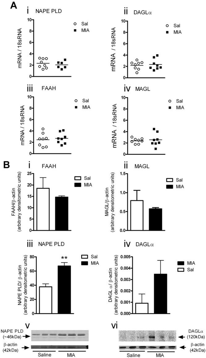 Comparative analysis of gene and protein expression of endocannabinoid-metabolizing enzymes in the ipsilateral spinal cord 28 days following intraarticular injection of mono-iodoacetate (MIA) or saline (Sal). A, Messenger RNA expression of N-acyl phosphatidylethanolamine phospholipase D (NAPE-PLD), diacylglycerol lipase α (DAGLα), fatty acid amide hydrolase (FAAH), and monoacylglyceride lipase (MAGL) relative to 18S RNA in saline-treated and MIA-treated rats. Bars show the mean. B, Top, Densitometric analysis of protein expression for FAAH, MAGL, NAPE-PLD, and DAGLα relative to β-actin in saline-treated and MIA-treated rats. Bars show the mean and SEM. Bottom, Immunoblots demonstrating elevated levels of NAPE-PLD and DAGLα, respectively, in MIA-treated rats. NAPE-PLD protein levels were significantly increased in the ipsilateral spinal cord of MIA-treated rats compared with saline-treated rats. There was significant protein expression of DAGLα in the ipsilateral spinal cord of MIA-treated rats, but the expression of DAGLα protein was at or below the limits of detection in saline-treated rats. n = 6–8 rats per treatment group for gene expression data, and n = 3 rats per treatment group for protein data. ∗∗ = P < 0.01 versus saline-treated rats, by unpaired t-test.