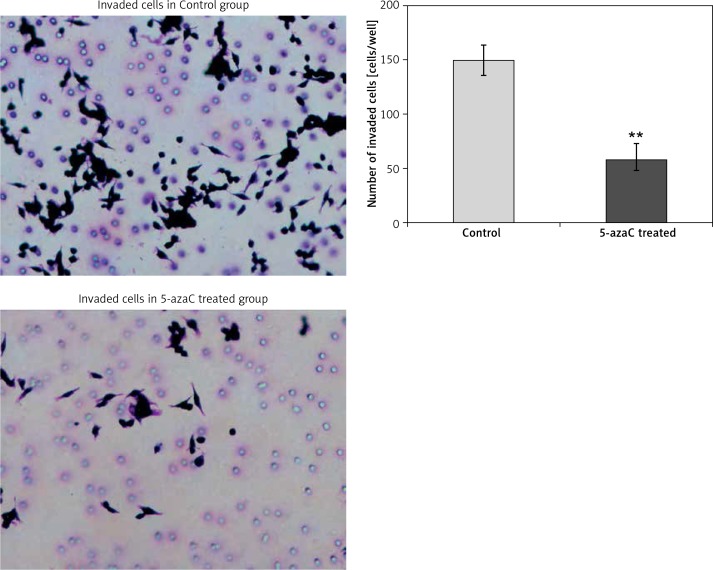 Invasion of colon cancer cells treated with 5-azaC. Treatment of SW620 cells with 5-azaC for 96 h significantly decreased their invasiveness (57.33 ±15.92 cells/well) when compared to the invasiveness of untreated SW620 cells (150.00 ±11.80 cells/well; t = 8.50; p = 0.001)**p < 0.01 (5-azaC treated vs. Control).