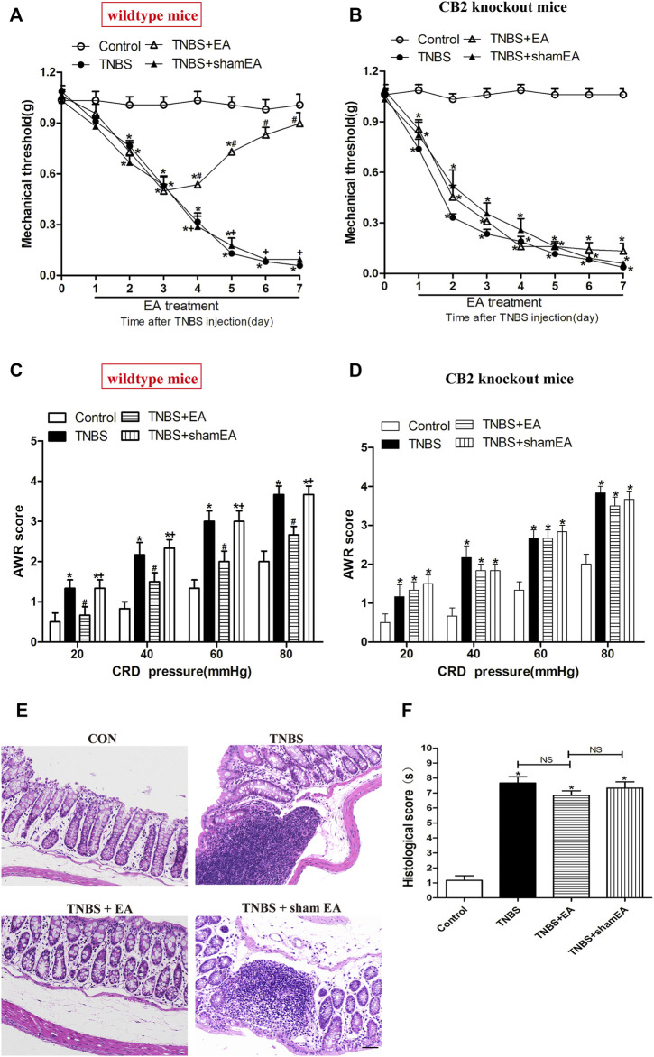 EA attenuates pain hypersensitivity induced by TNBS through CB2 receptors. (A–D) Time course of mechanical withdrawal threshold in wild-type (A) and CB2 receptor knockout (B) mice treated with TNBS. AWR scores in wild-type (C) and CB2 receptor knockout (D) mice treated with TNBS on day 7. (E) Representative H&E staining of the colon tissue sections in CB2 receptor knockout mice. Scale bar, 50 μm. (F) Histological score in each group (n = 6 per group). *p < 0.05 versus with Control group, #p < 0.05 versus with TNBS group, +p < 0.05 versus with TNBS + EA group. NS, no significance versus Sham EA group as indicated.